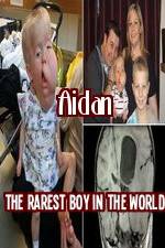 Watch Aidan The Rarest Boy In The World Zumvo