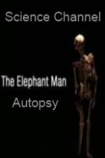 Watch Science Channel Elephant Man Autopsy Zumvo