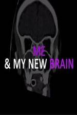 Watch Me & My New Brain Zumvo