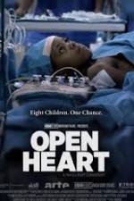 Watch Open Heart Zumvo