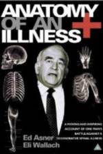 Watch Anatomy of an Illness Zumvo