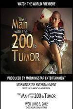 Watch The Man With The 200lb Tumor Zumvo