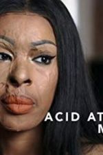 Watch Acid Attack: My Story Zumvo