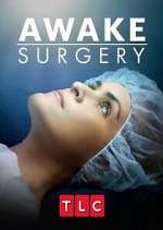 Watch Awake Surgery Zumvo