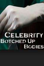 Watch Celebrity Botched Up Bodies Zumvo